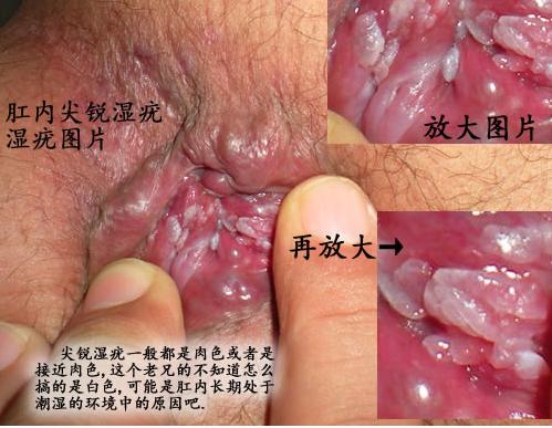 铜仁男科医院