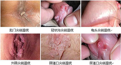 铜仁男科医院