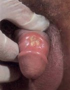 铜仁男科医院